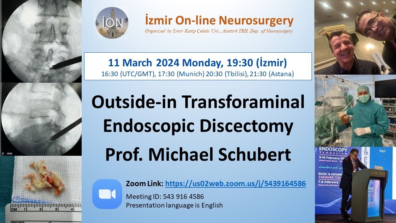 İON 427. Lecture, Schubert: Outside-in Transforaminal Endoscopic Discectomy 11.03.2024