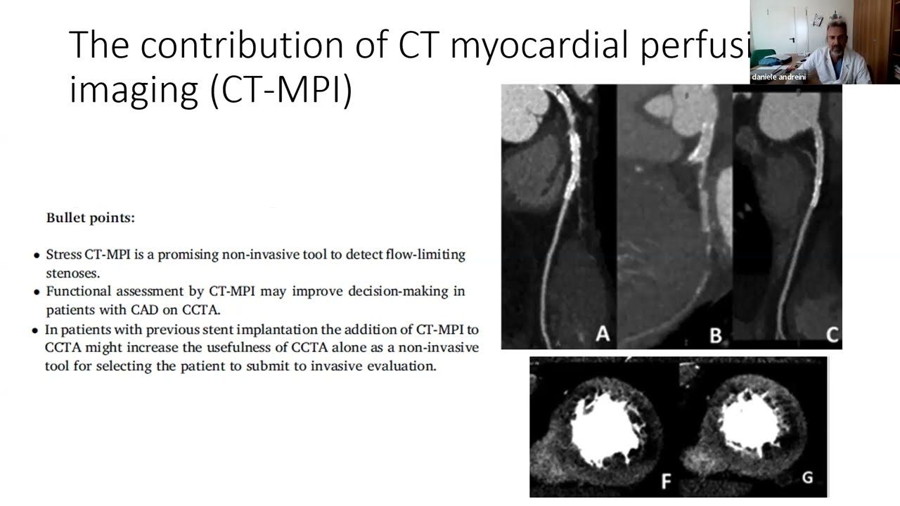 Expert consensus review: Pre-procedural planning of coronary revascularization by cardiac CT