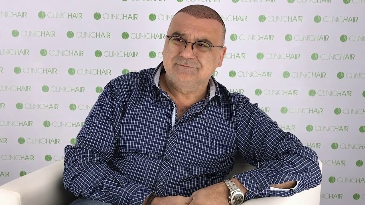 Testimonials After Hair Transplant First Wash