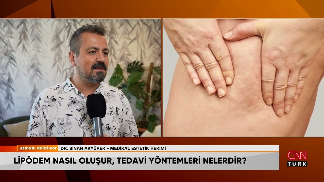 What is lipedema? What are the symptoms? Is it curable?