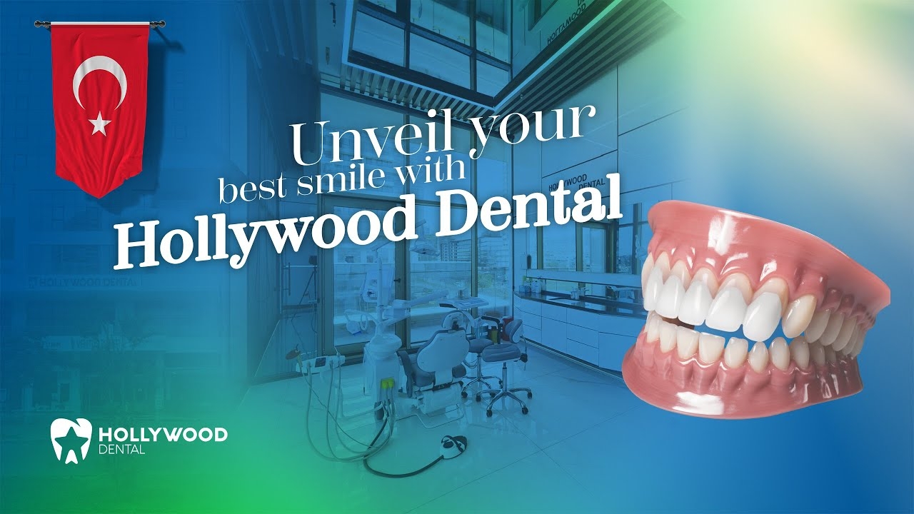 Step by Step Dental Veneers in Turkey