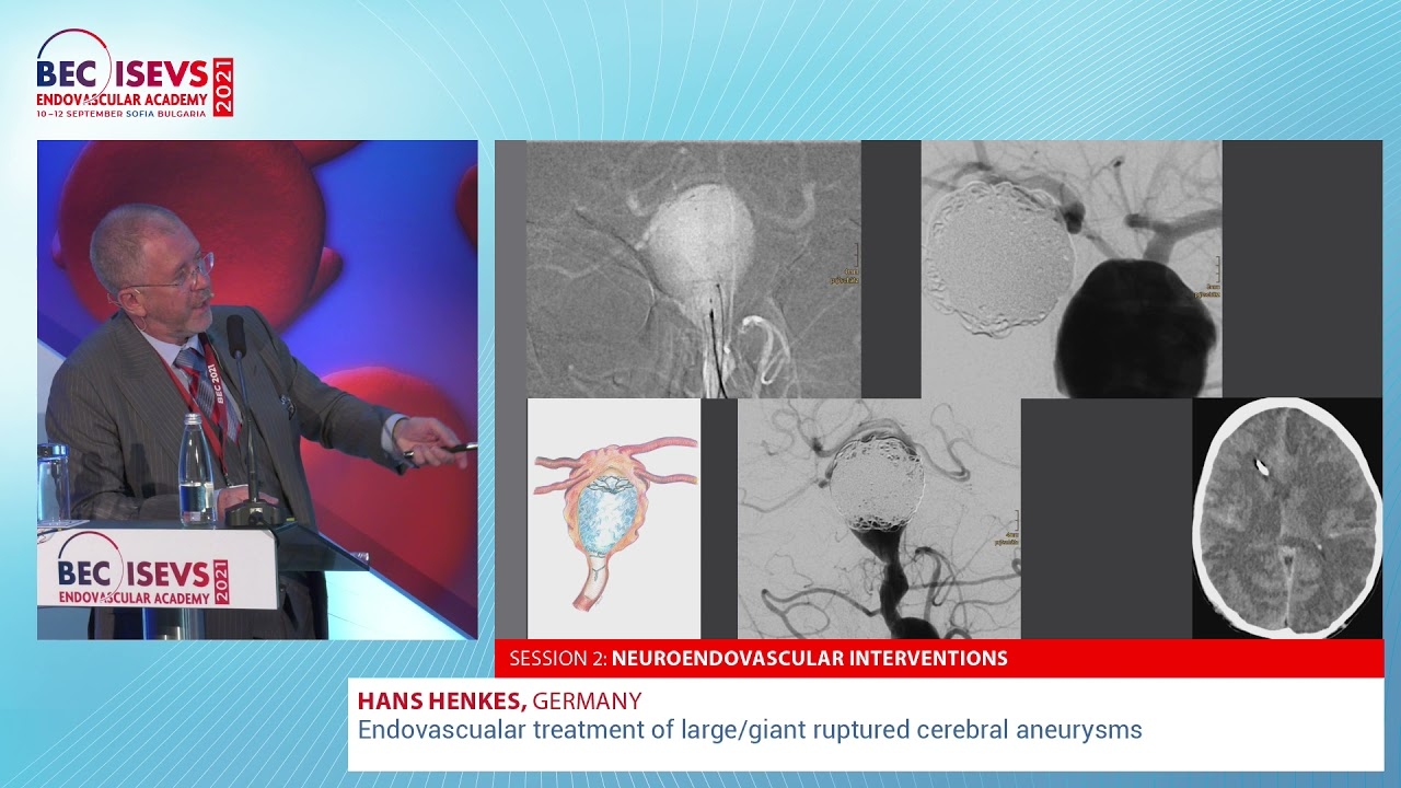 BEC 2021 | Endovascualar treatment of large/giant ruptured cerebral aneurysms | Hans Henkes