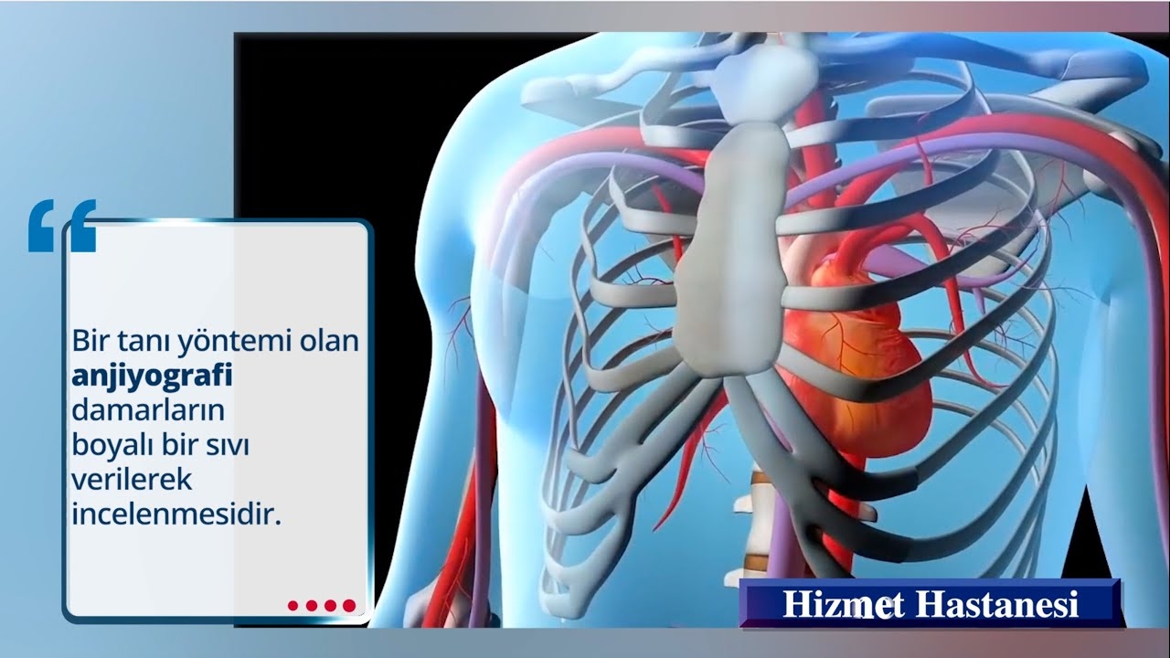 What is angiography? - Assoc. Dr. Kahraman Coşansu (Cardiology)