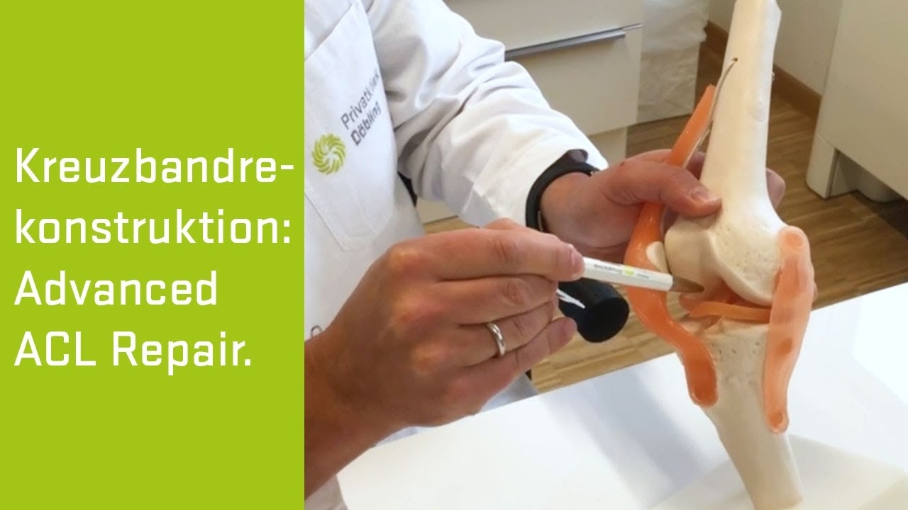 Cruciate ligament injury or cruciate ligament rupture? Cruciate ligament reconstruction with Advanced ACL Repair