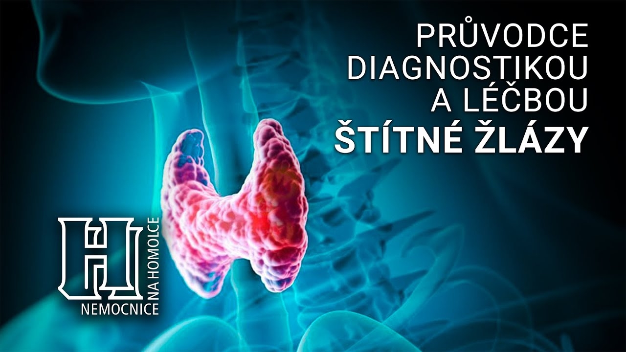 Thyroid Diagnosis and Treatment Guide