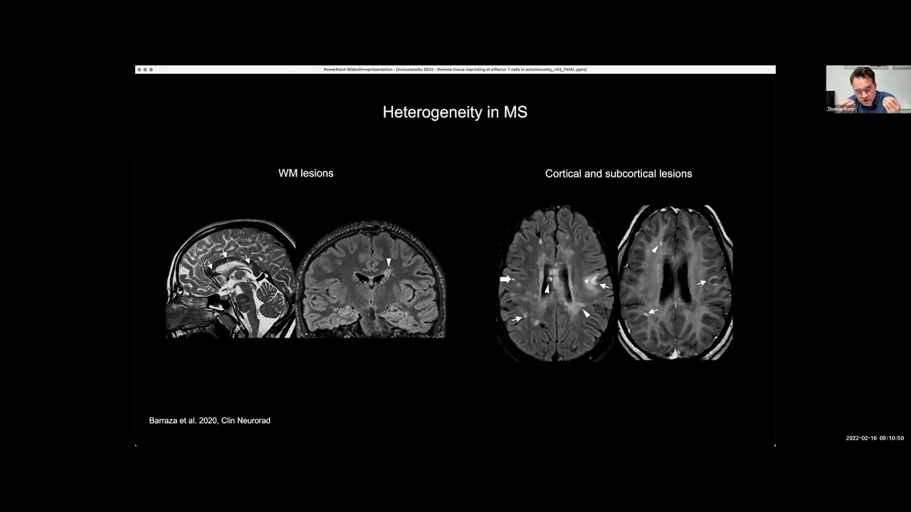 Tissue imprinting of autoreactive T cells by Dr. Thomas Korn