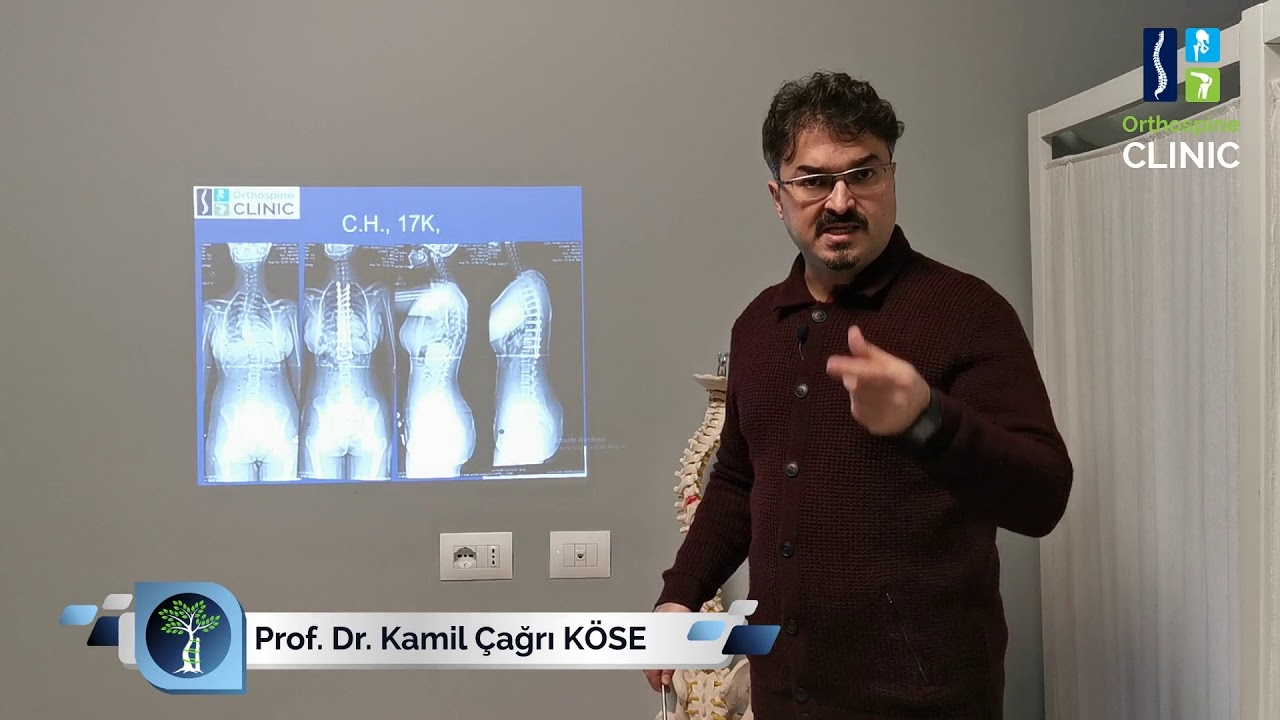 I had scoliosis surgery on my back, my lower back hurts, will I be relieved if my screws are removed?