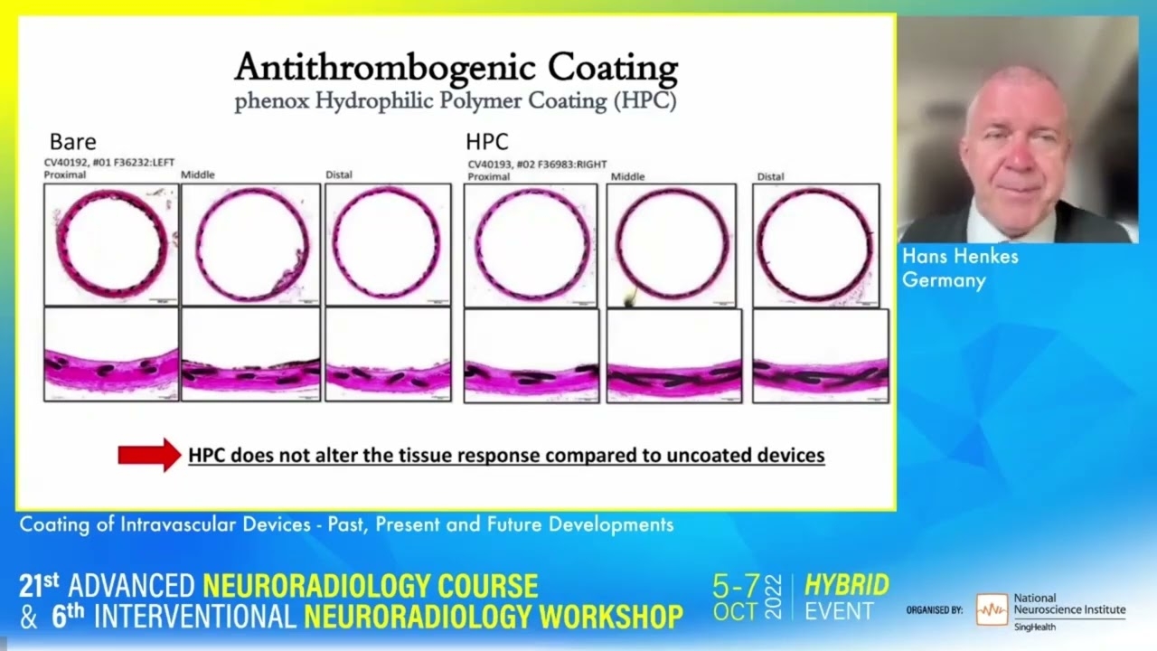 Coating of Intravascular Devices - Past, Present, and Future Developments - Hans Henkes