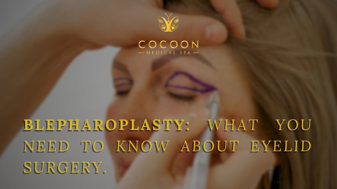 BLEPHAROPLASTY || COCOON MEDICAL SPA || EYELID