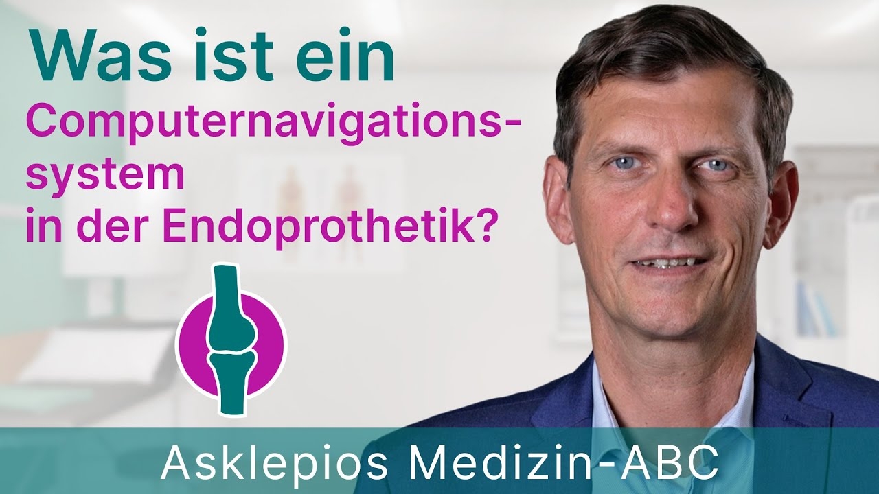 What is a computer navigation system in arthroplasty? - Medicine ABC | Asklepios