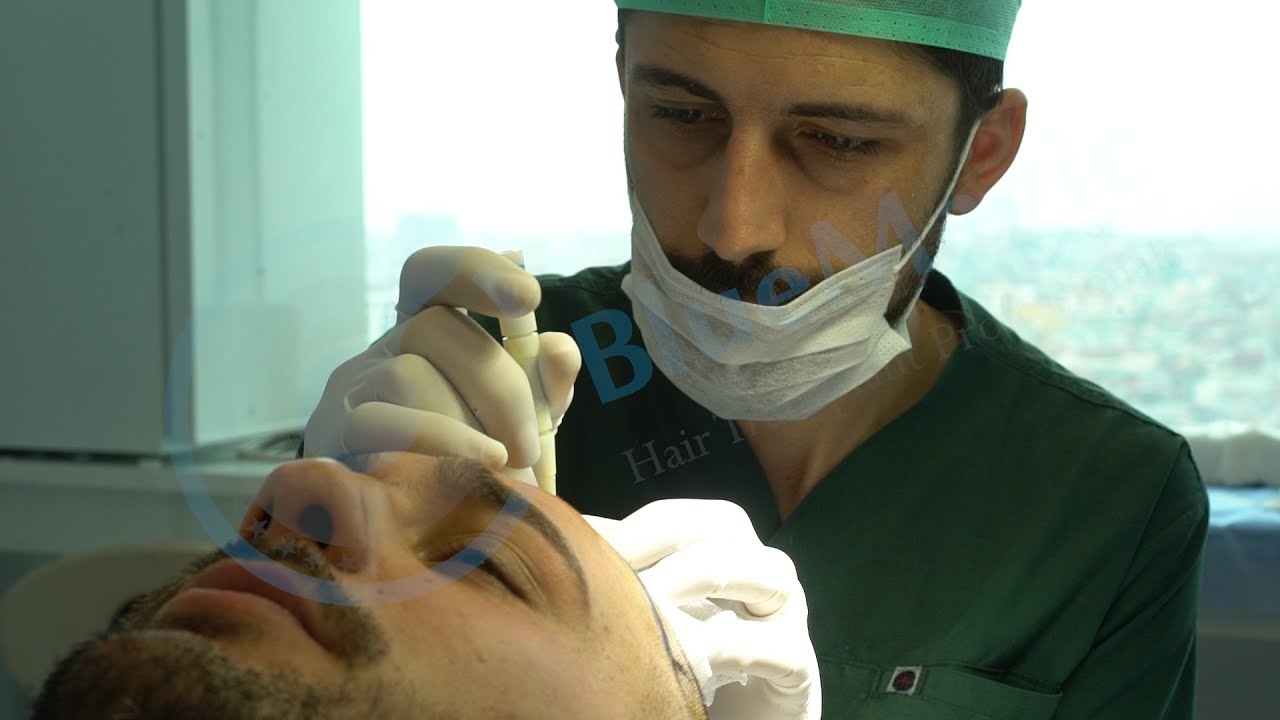 5000 GRAFTS HAIR TRANSPLANT COST | Hair Transplant Testimonials | BlueMagic Group Reviews