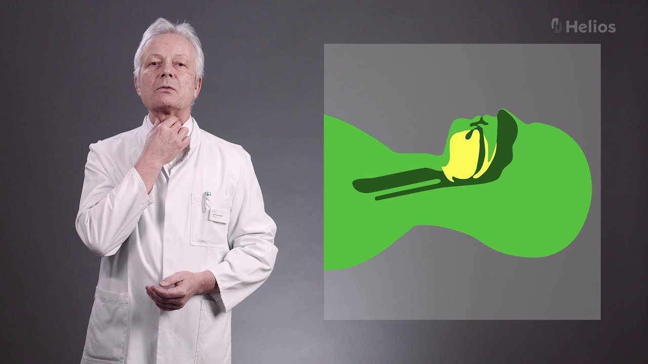 Sleep apnea: Explanation and treatment in a sleep laboratory