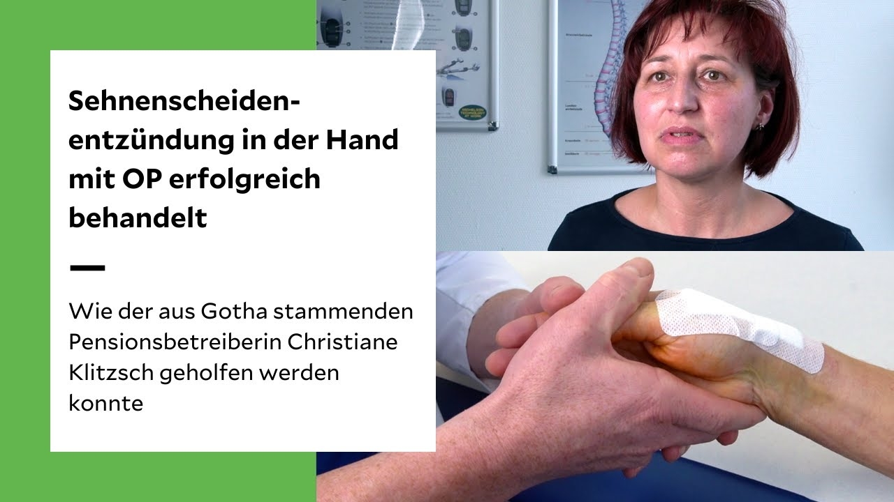 Tendon sheath inflammation following a hand injury | How surgery can help