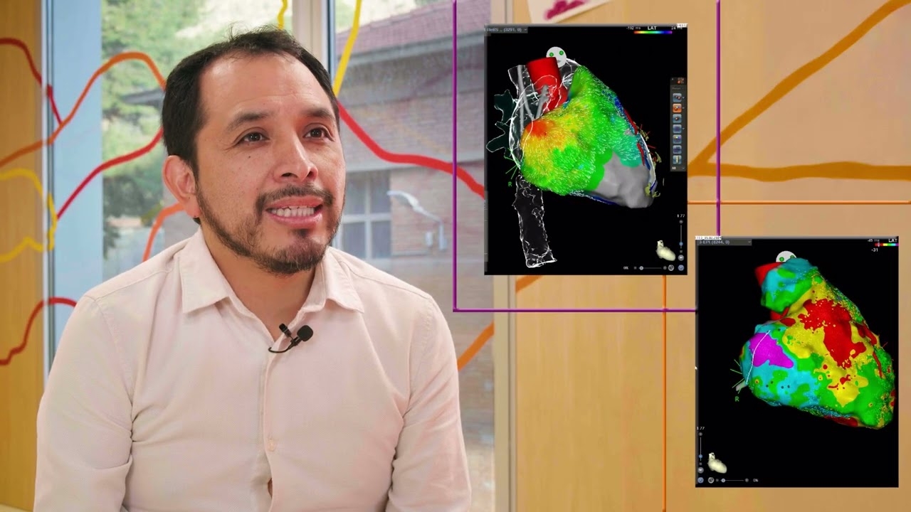 New ablation techniques to treat cardiac arrhythmias in pediatrics