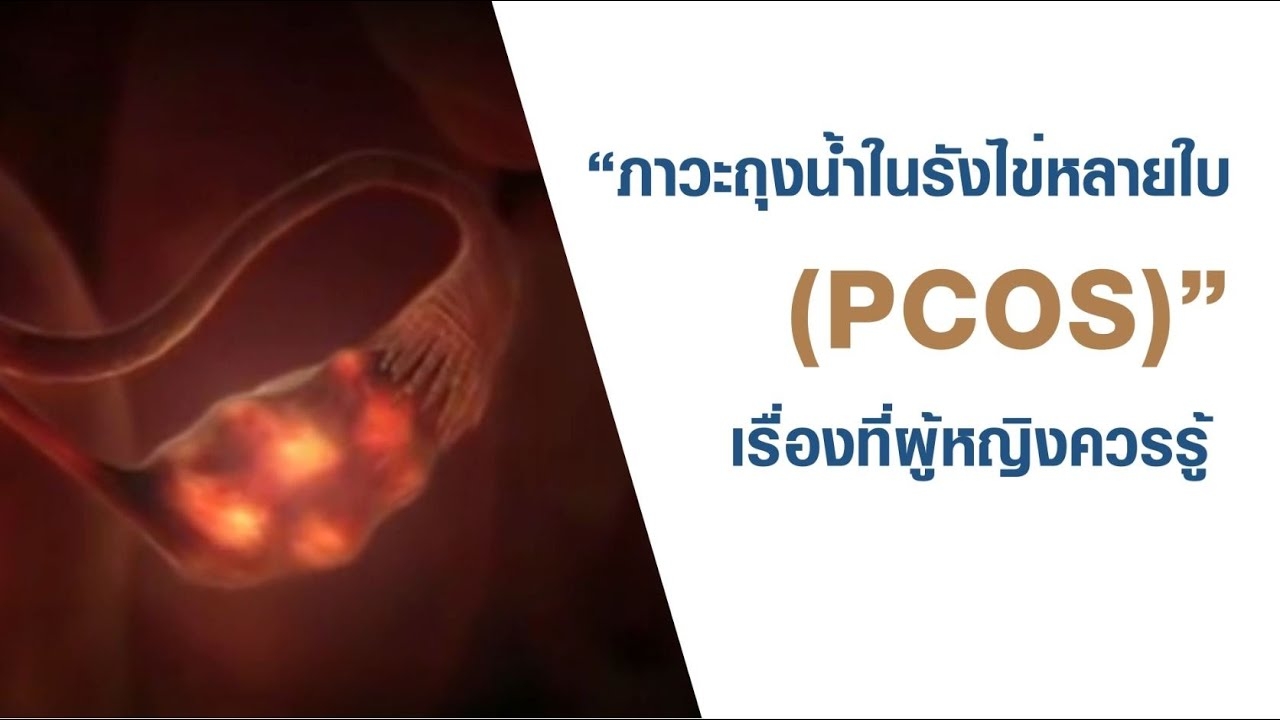 Multiple Ovarian Cysts (PCOS) Things Women Should Know