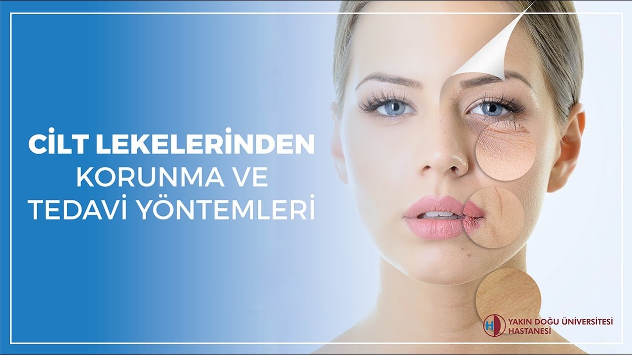 Near East University Hospital, Assistant Professor Dr. Didem Mullaazziz- Skin spots