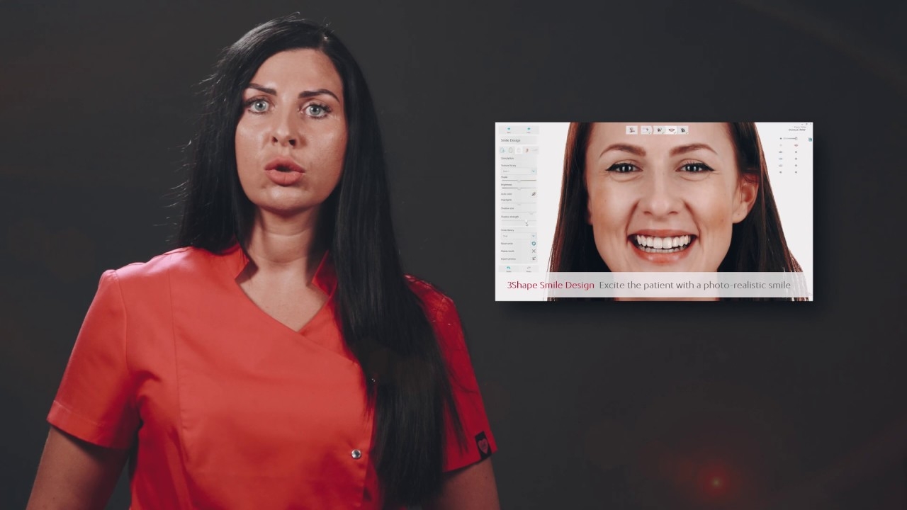 3D intraoral scanner - advantages - Albodent