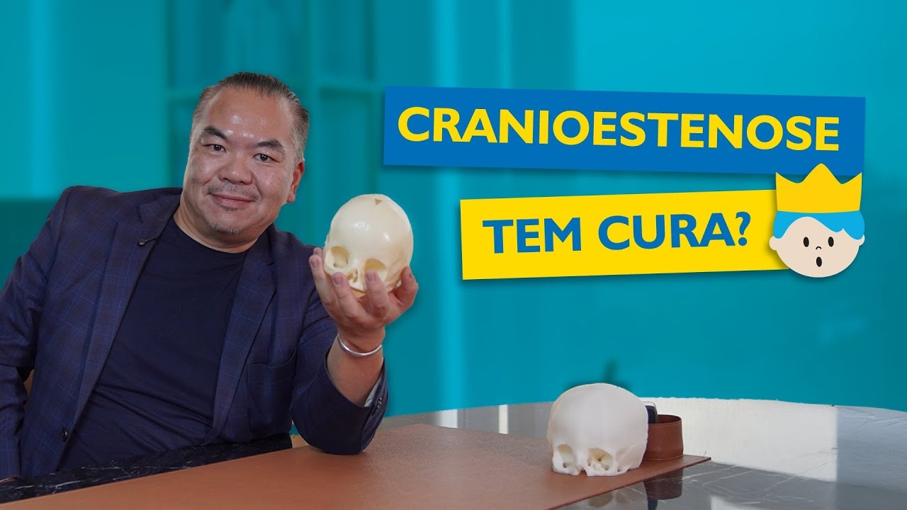 Craniosynostosis: What it is, how to identify it, and treatment!