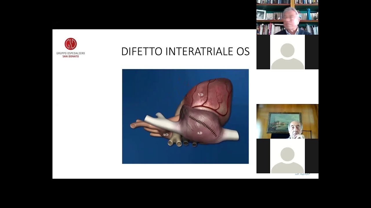 The interatrial defect: surgical closure - Alessandro Varrica