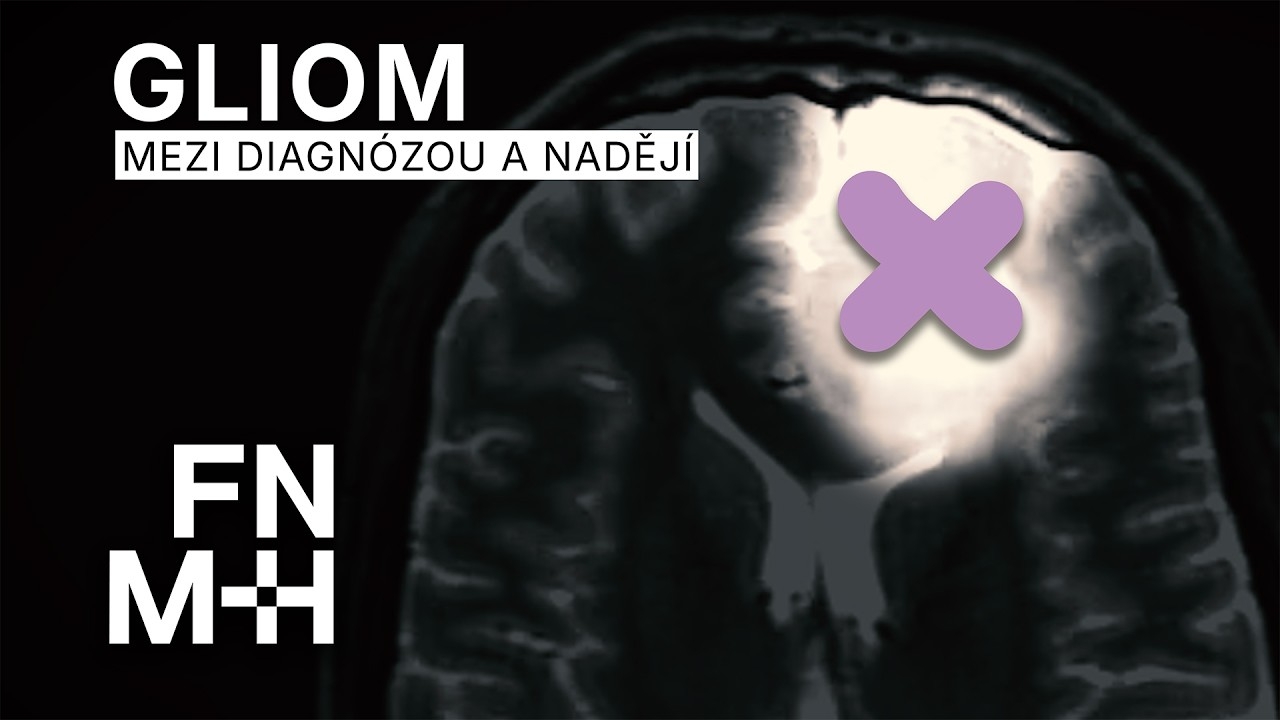Glioma — Between Diagnosis and Hope