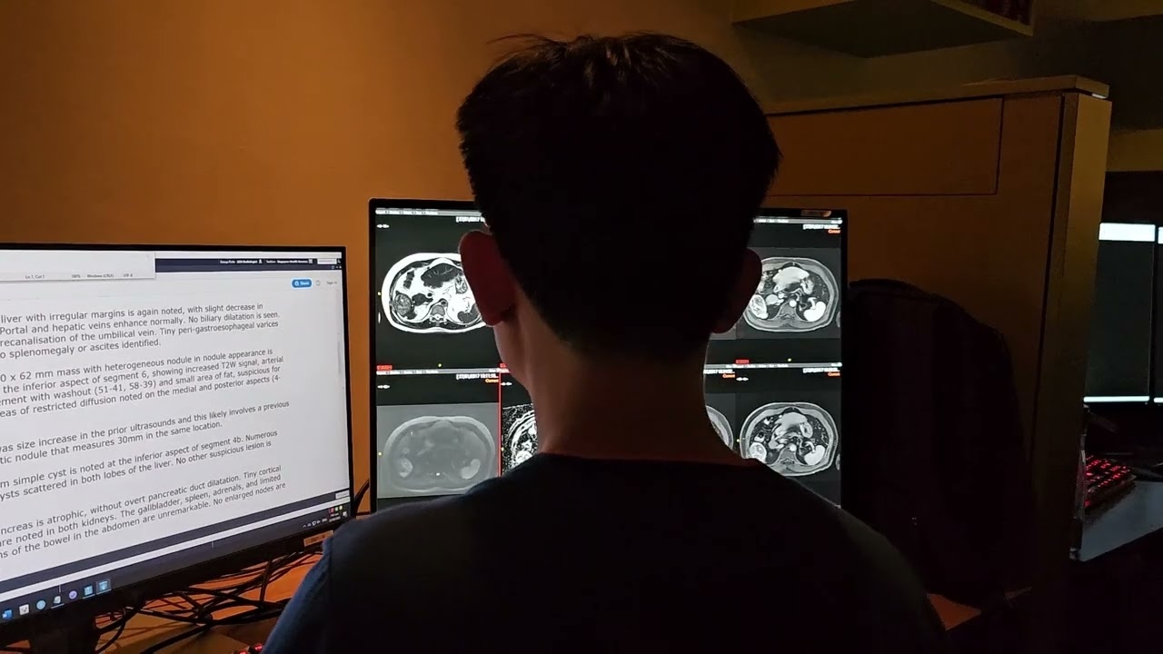 RAPIER: Using AI to identify liver tumours