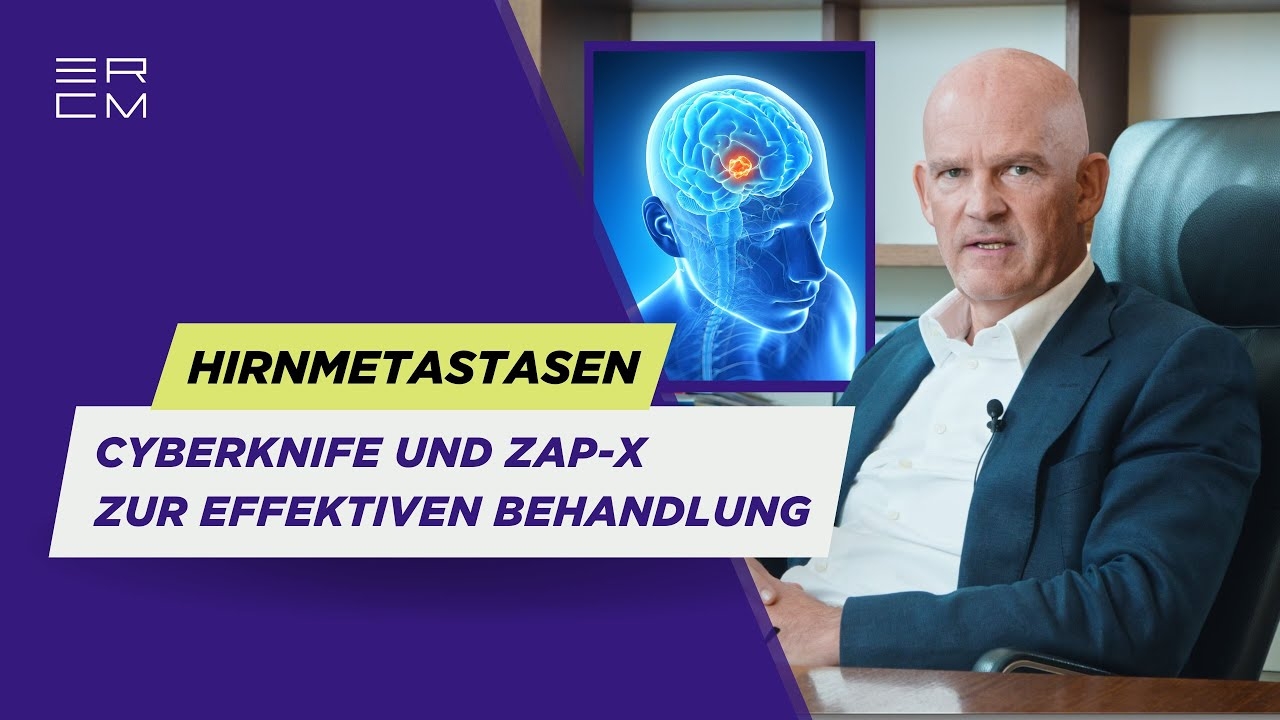 Brain metastases: gentle and effective treatment with CyberKnife & ZAP-X