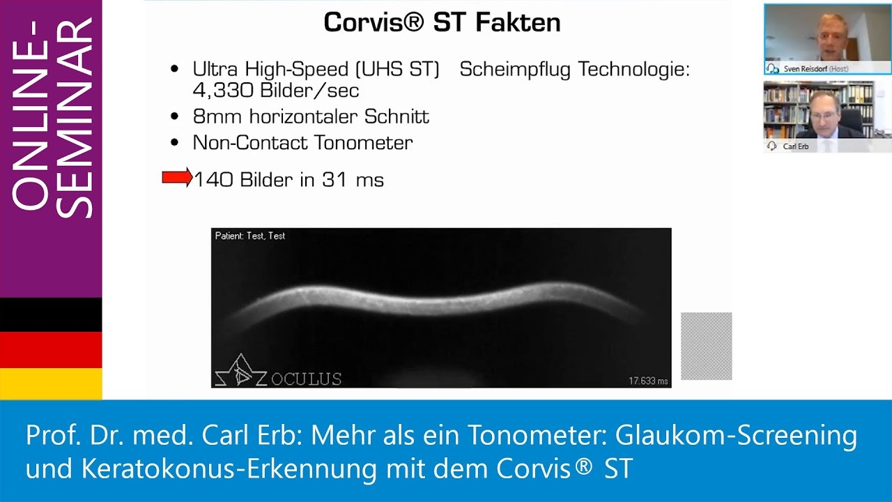 More than just a tonometer: glaucoma screening and keratoconus detection with Corvis® ST