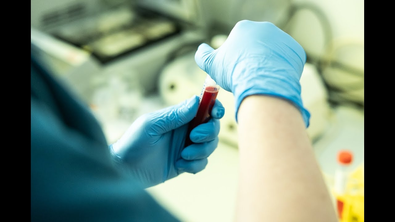 Treatment of rare diseases at the University Hospital in Cracow