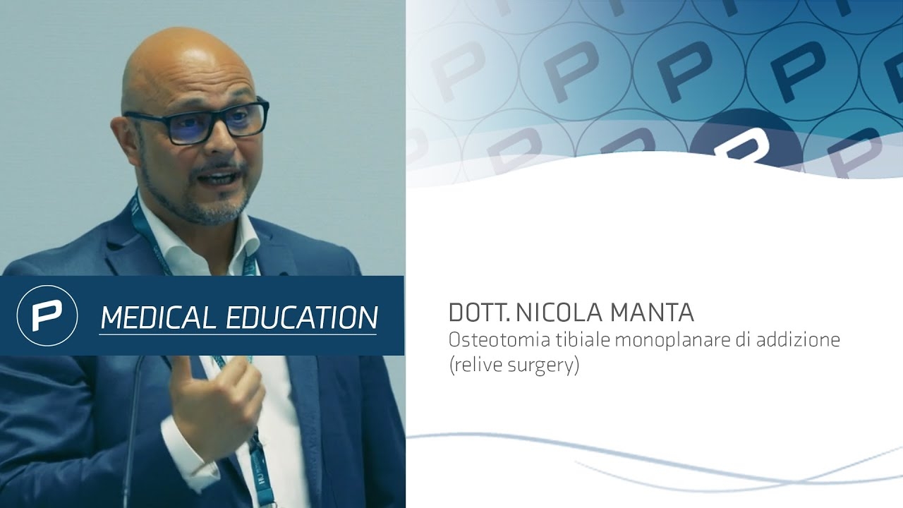 Dr. Nicola Manta - Monoplanar tibial addition osteotomy (relive surgery)