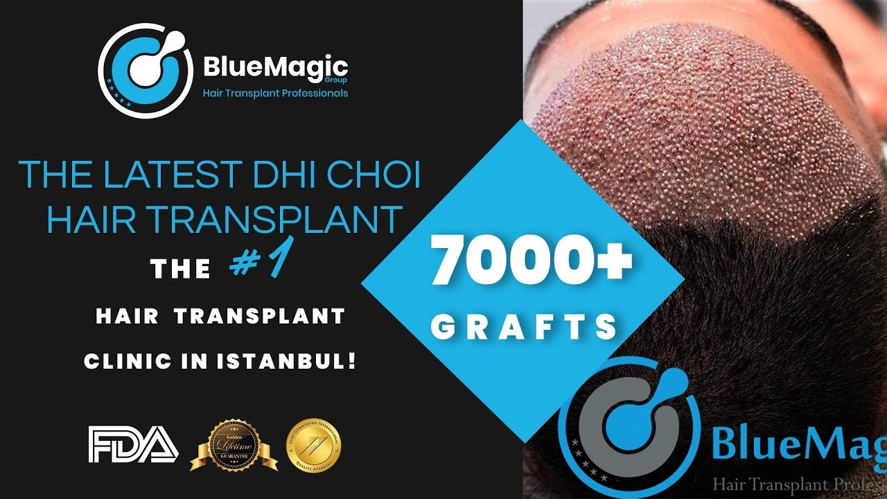 HAIR TRANSPLANT ISTANBUL | THE LATEST DHI-CHOI TECHNIQUE | UP TO 8000 GRAFTS IN 2 SESSIONS