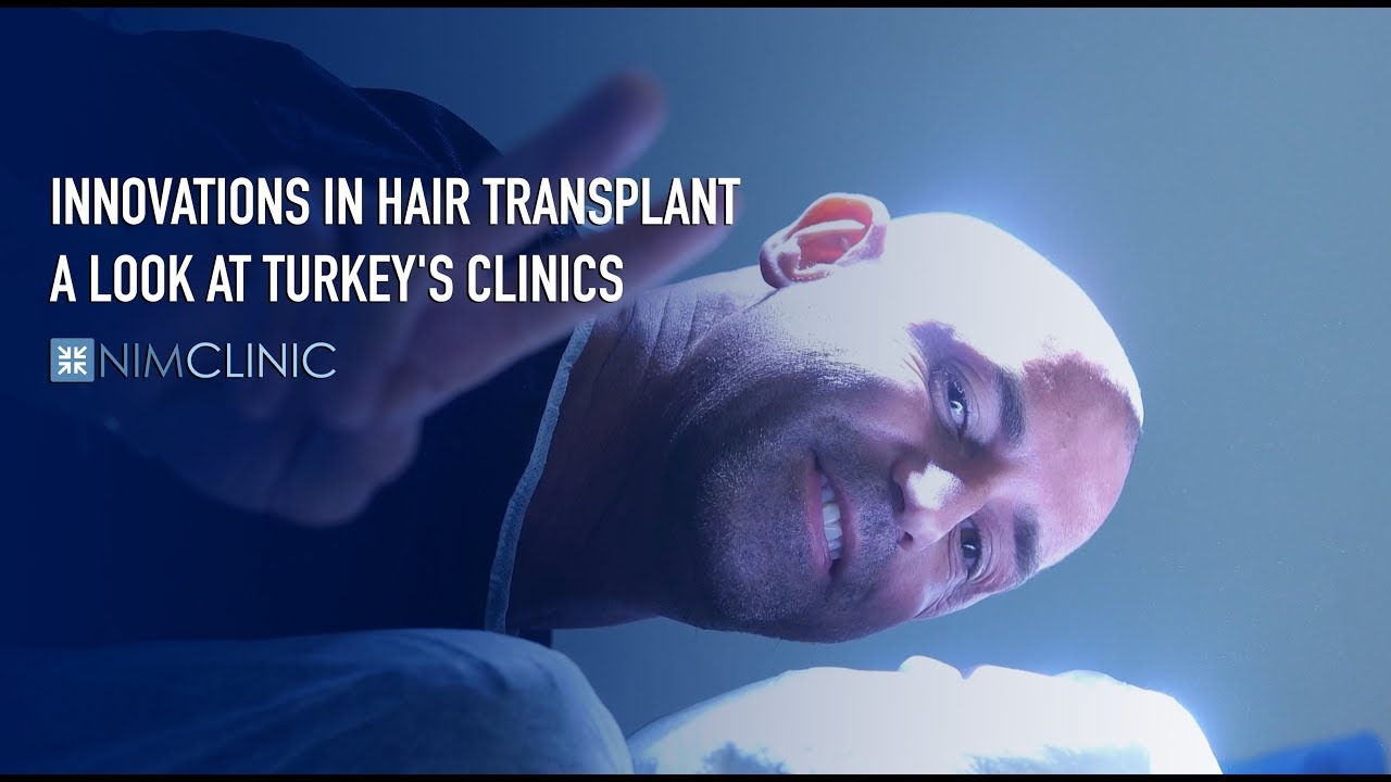 Innovations in Hair Transplant A Look at Turkey's Clinics