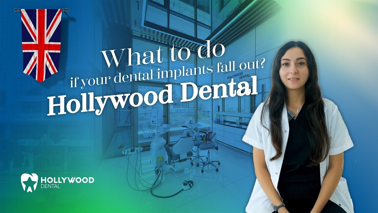 What To Do if Your Dental Implants Fall Out?