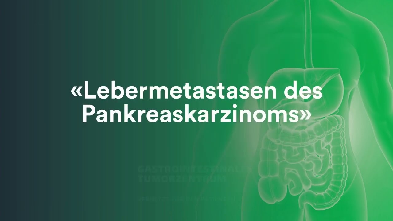 Liver metastasis of pancreatic cancer