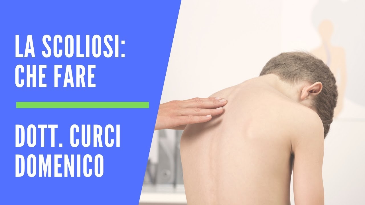 Scoliosis, Symptoms, Diagnosis and Treatment | Dr. Domenico Curci Orthopedist