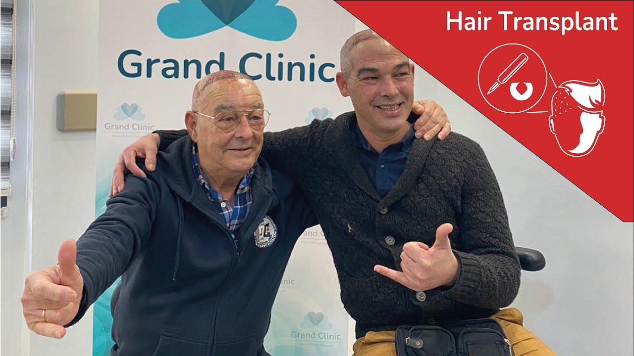 Hair Transplant | Happy Patient Review