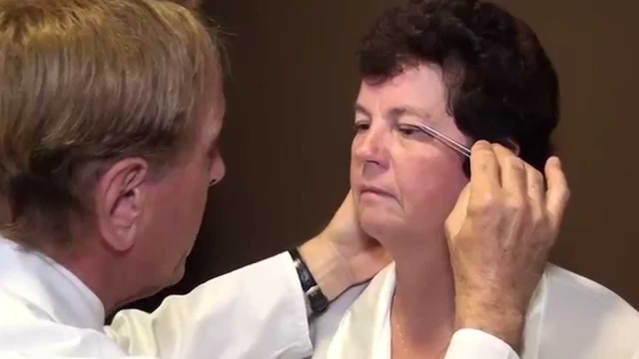 Blepharoplasty – eyelid surgery