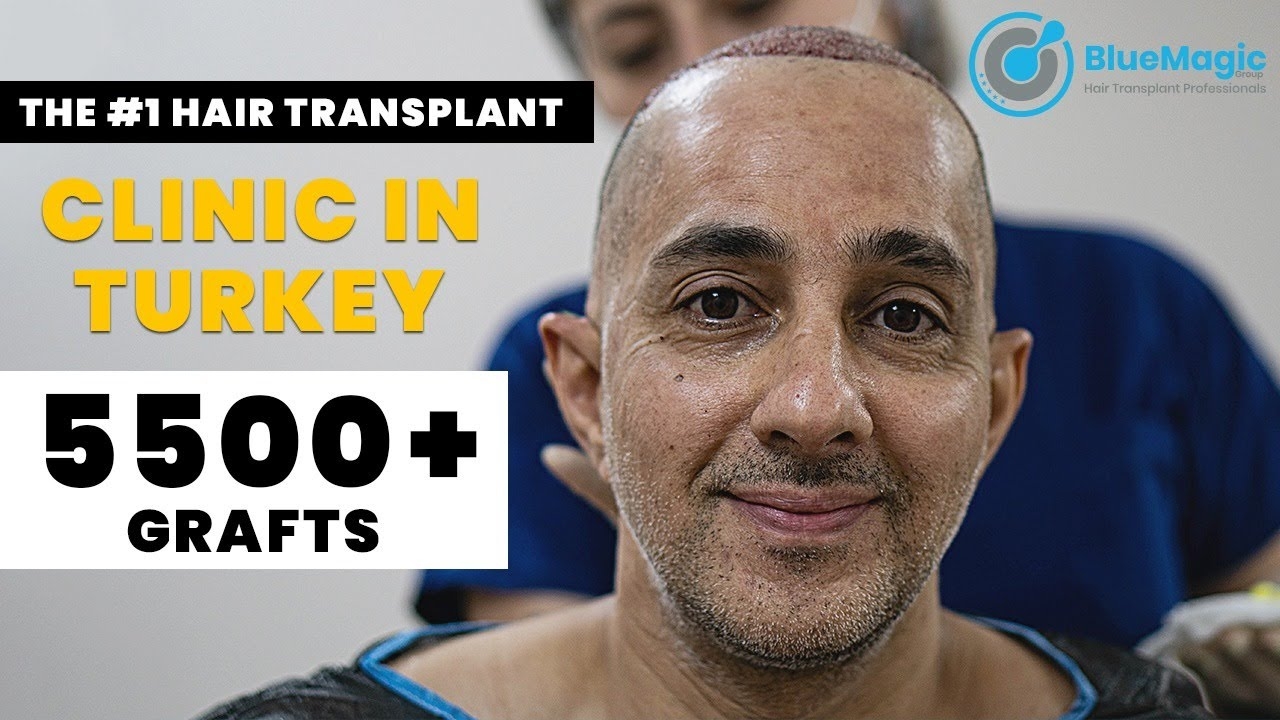 BlueMagic Group Reviews | BEST HAIR TRANSPLANT CLINIC IN ISTANBUL | TRAPIANTO DI CAPELLI TURCHIA