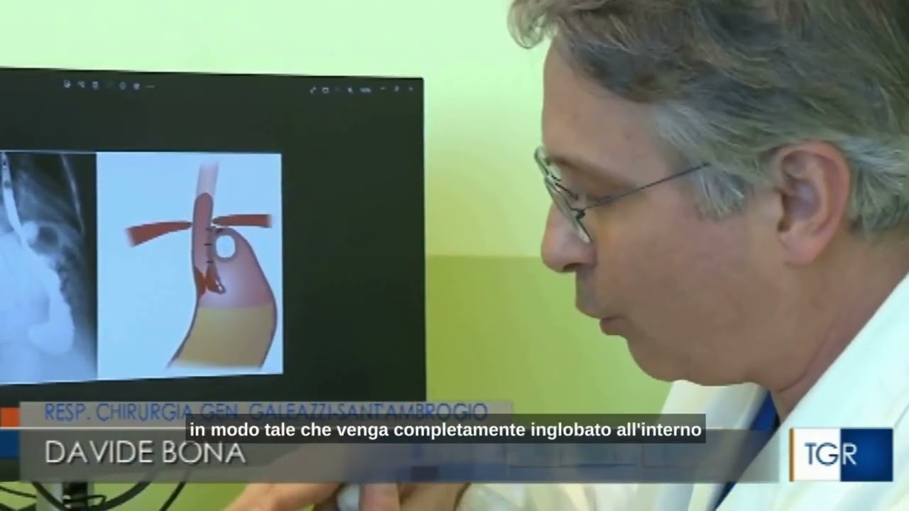 RA13 Public National TV, Italy: Professor Davide Bona on the RefluxStop™ procedure for acid reflux