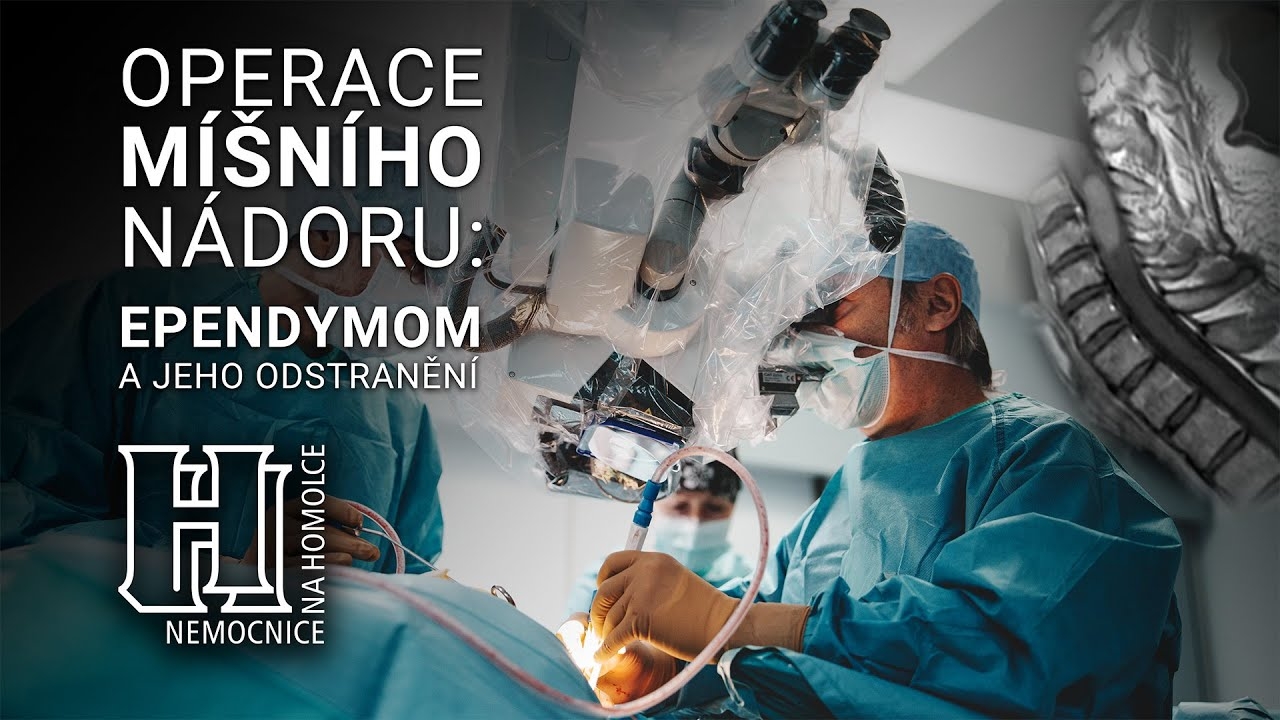 Spinal tumor surgery: Ependymoma and its removal