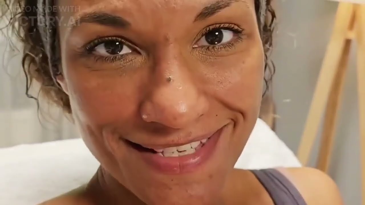 Lejla Abbas and Hollywood peeling at the Formé clinic.