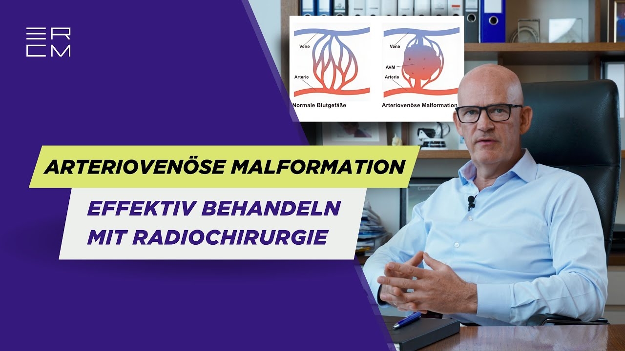 Effectively treat arteriovenous malformation (AVM) with radiosurgery