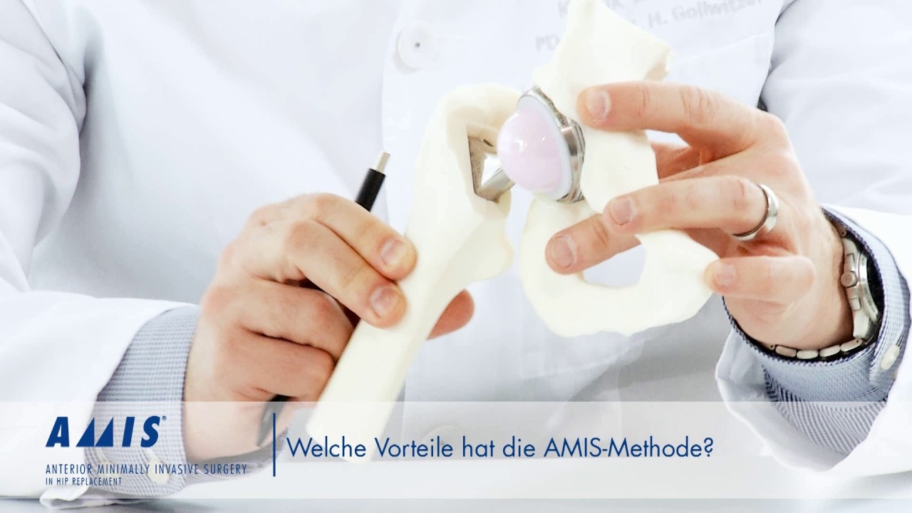Benefits of the AMIS method | Interview with Prof. Gollwitzer