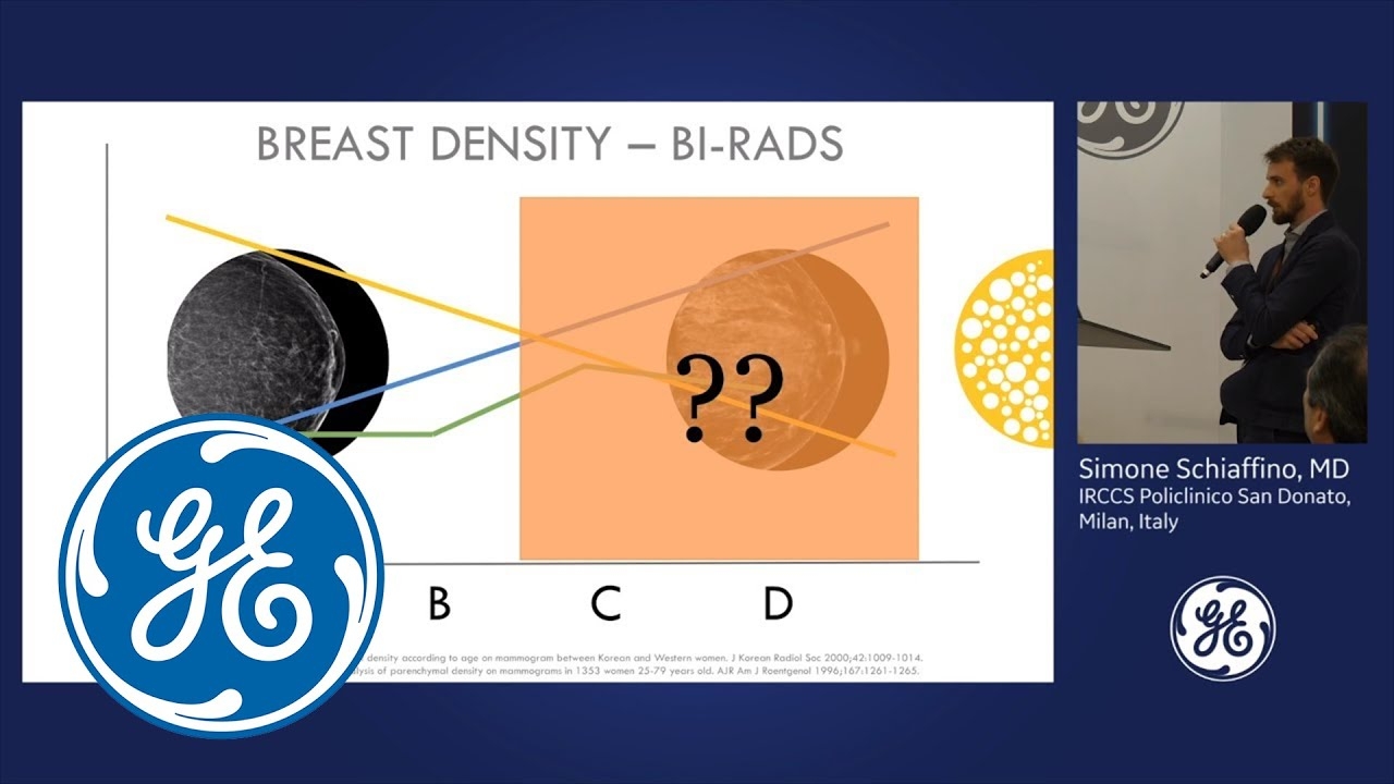 ECR 2019: Are we ready for Automated Breast Ultrasound (ABUS) coronal view? | GE Healthcare