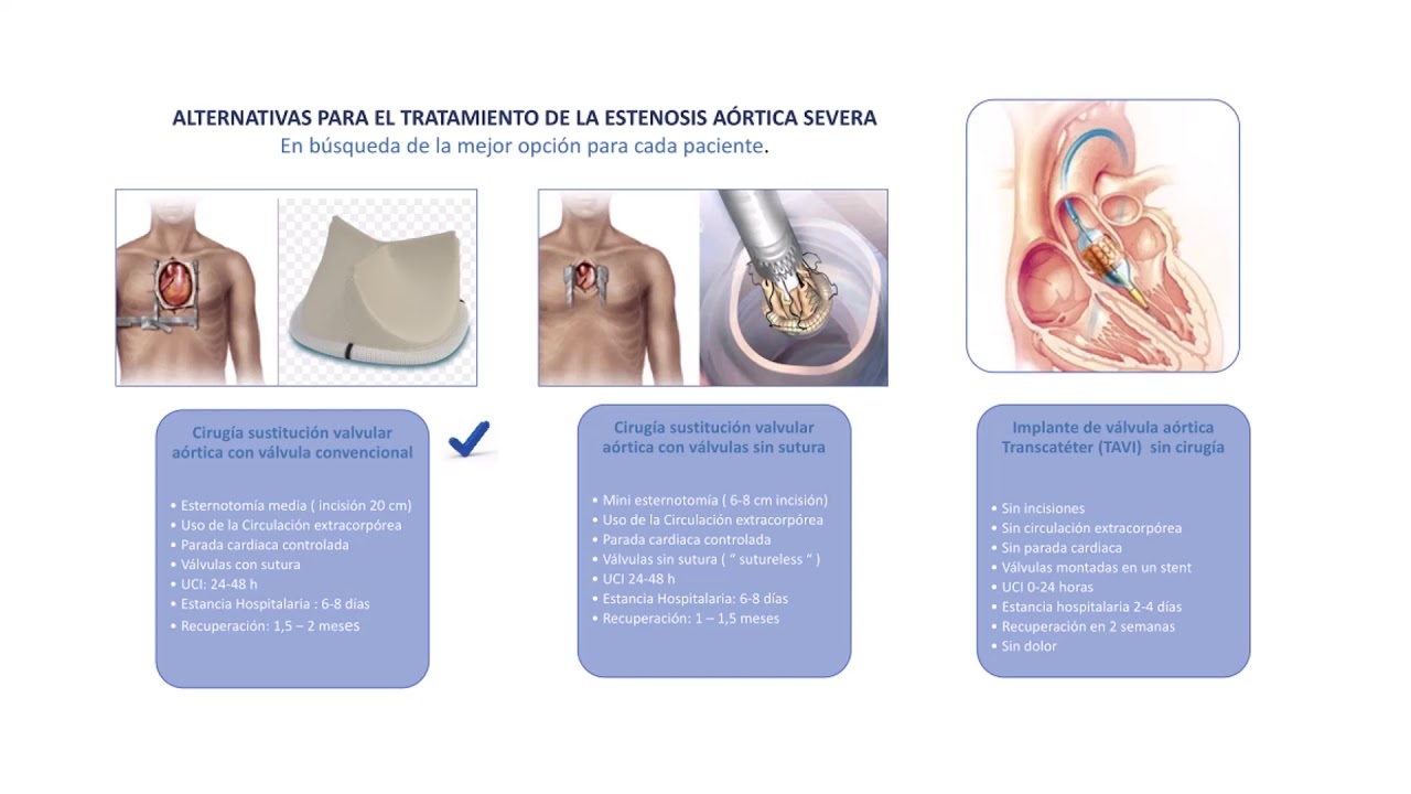 Severe Aortic Stenosis