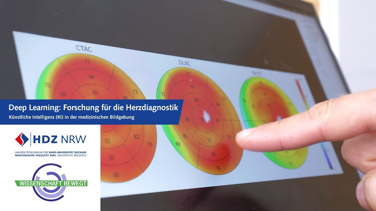Deep learning: research for heart diagnostics