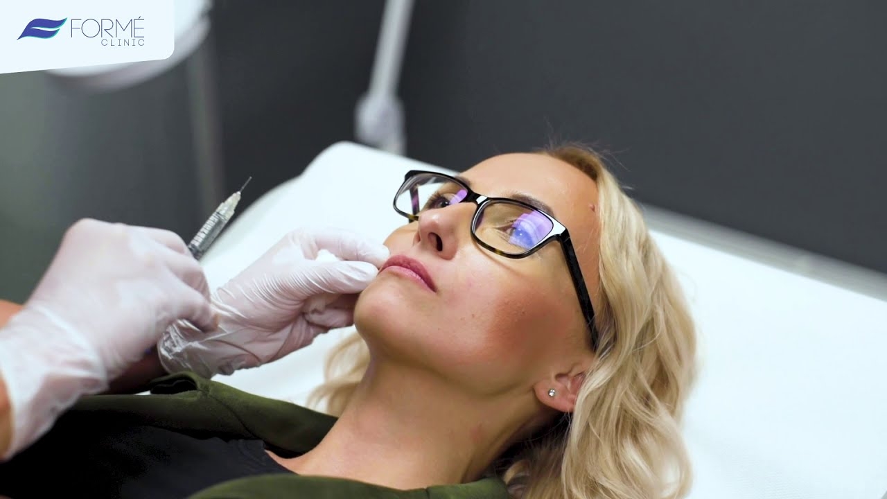 Application of hyaluronic acid to the lip