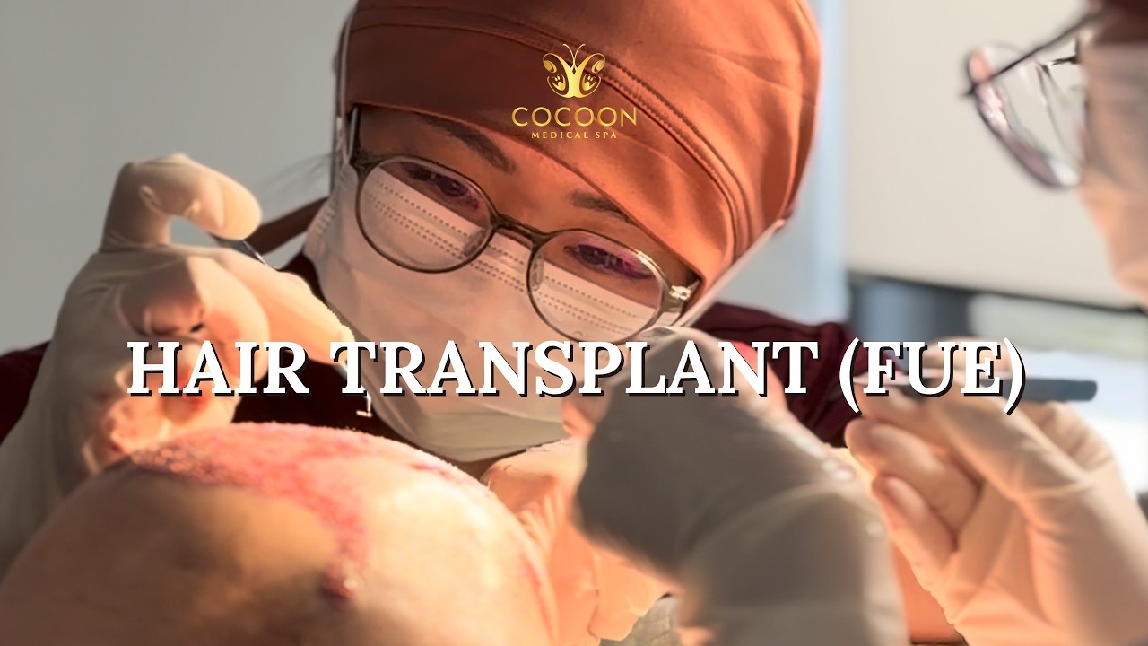 Cocoon Medical Spa - Hair Transplant Treatment (FUE)