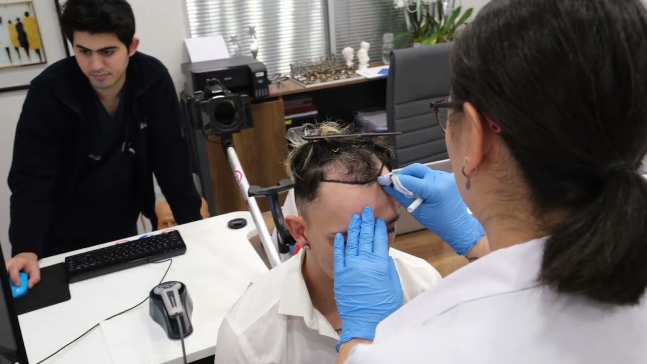 Life-Changing Hair Transformation at Estecapelli | Our Patient's Inspiring Journey ?‍♂️✨