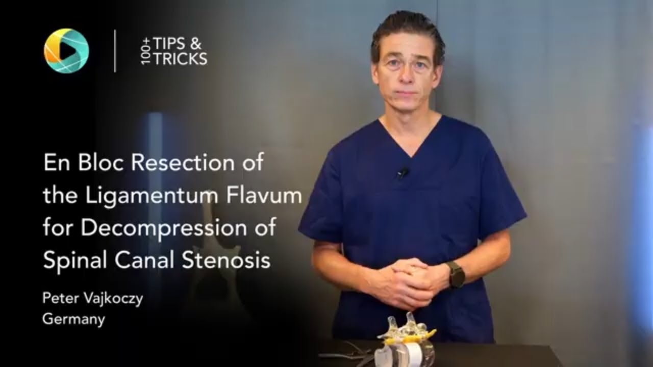 En Bloc Resection of the Ligamentum Flavum for Spinal Canal Decompression by Vajkoczy #spinesurgery