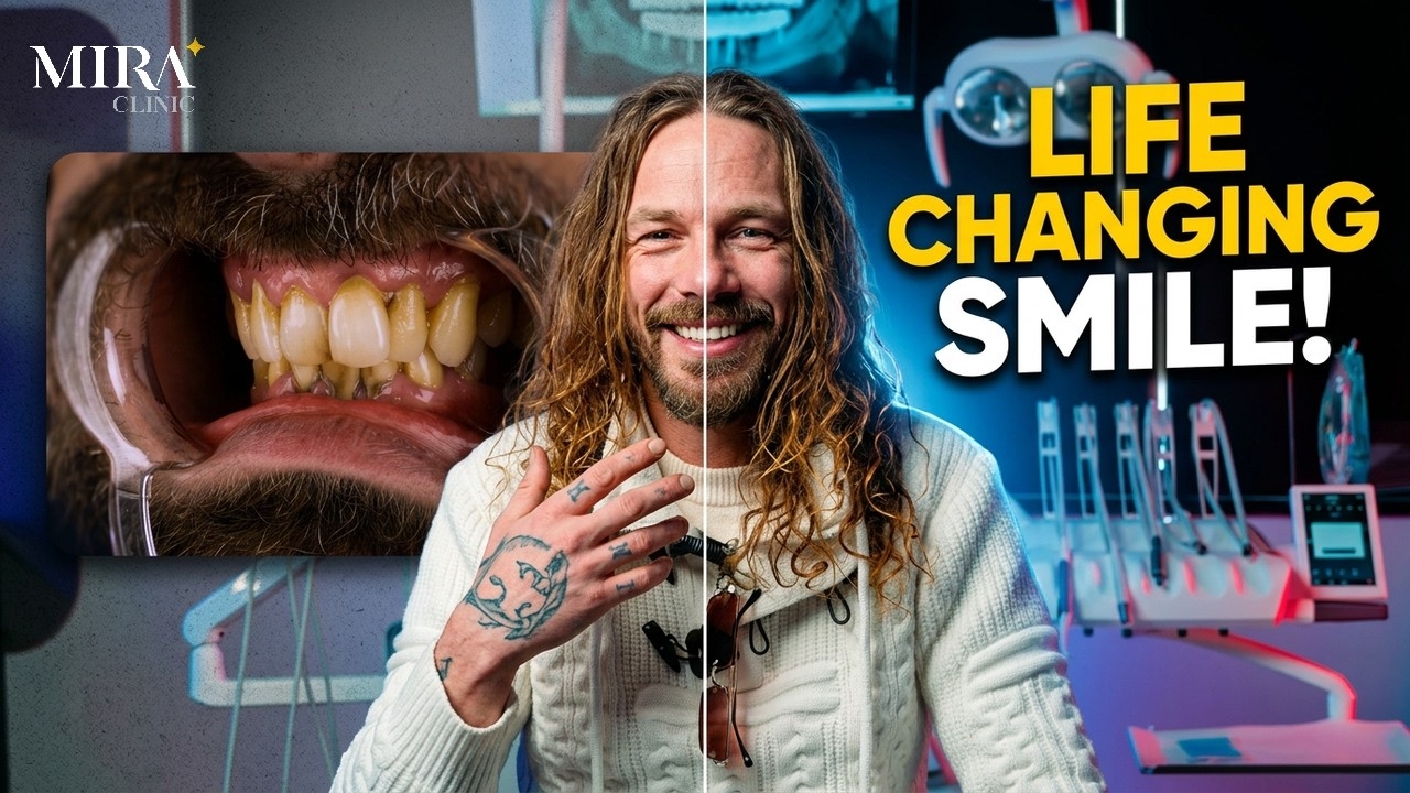 He Asked All the Right Questions Before His Smile Makeover